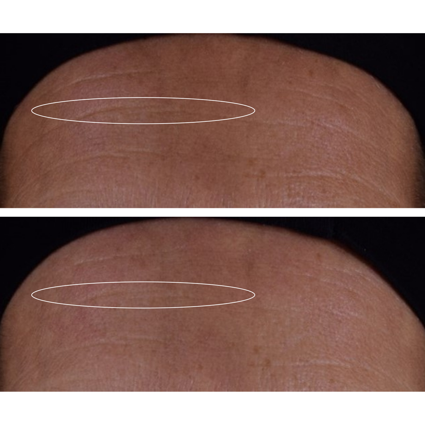 Une efficacité cliniquement prouvée