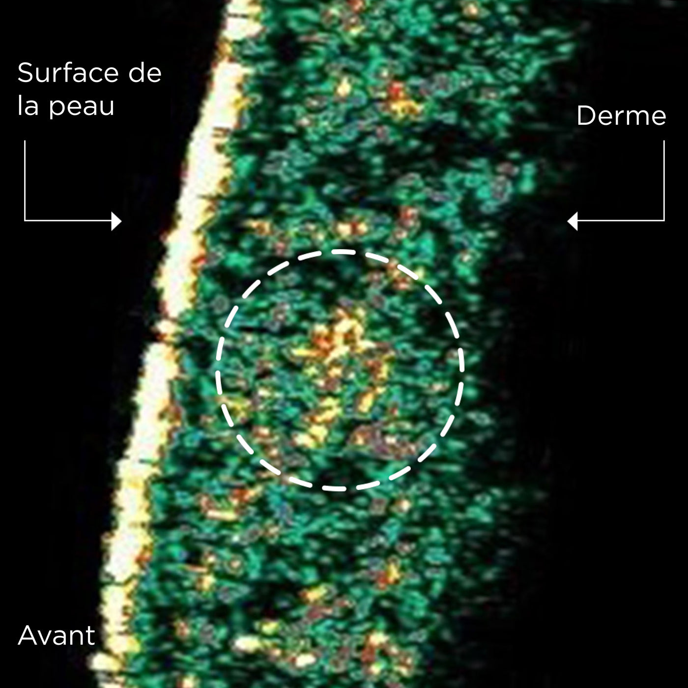 UNE ACTION RAFFERMISSANTE [[CLINIQUEMENT PROUVÉE]]