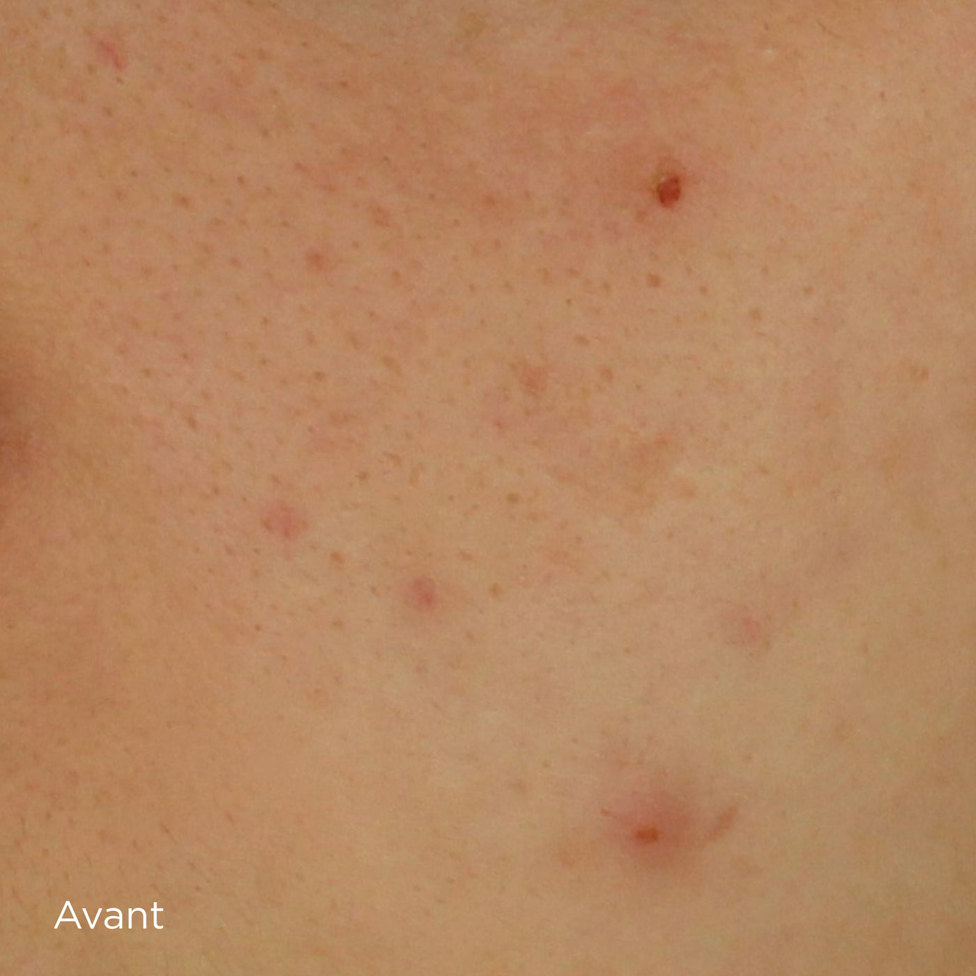 une action anti-imperfections [[cliniquement prouvée]]