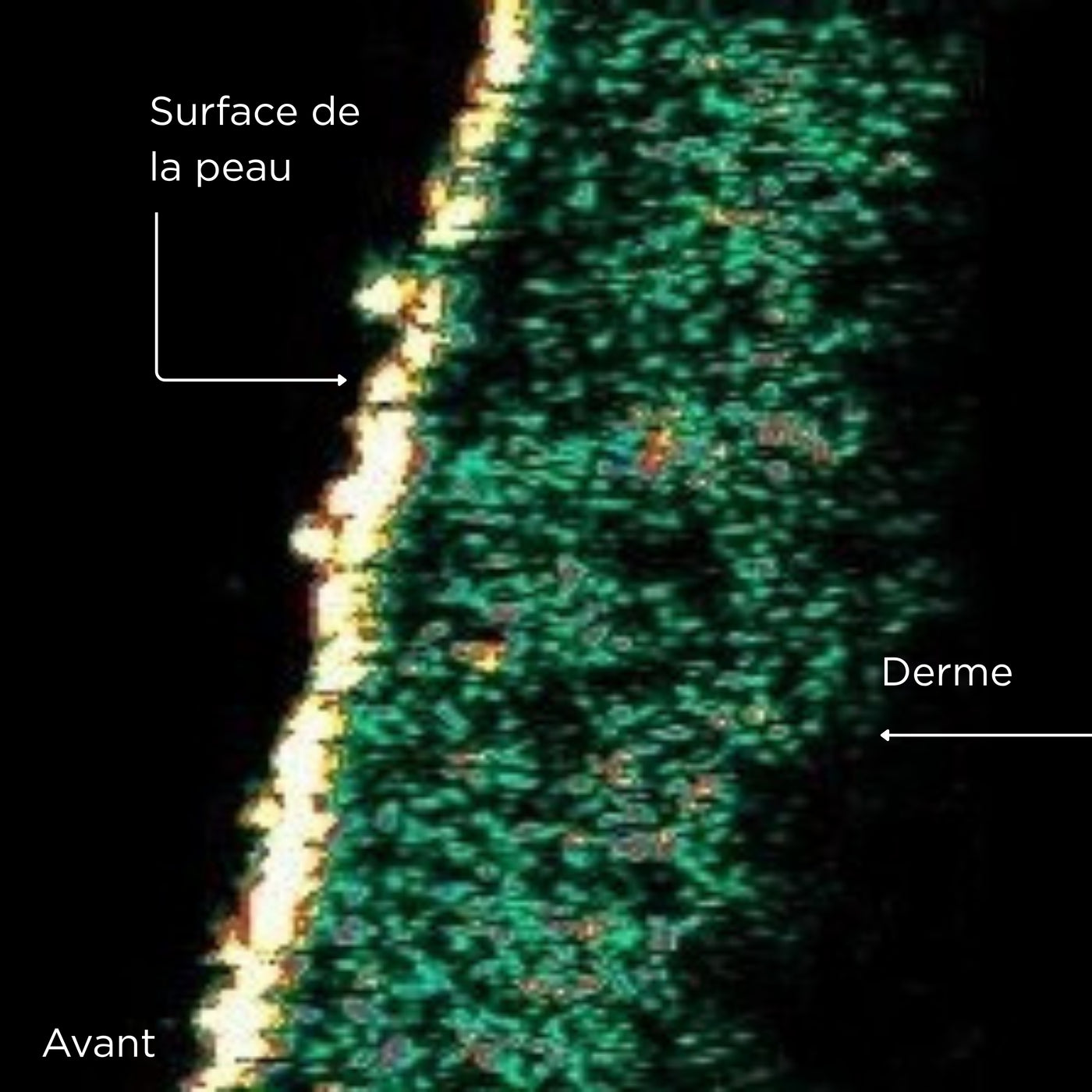 UNE ACTION RAFFERMISSANTE [[CLINIQUEMENT PROUVÉE]]