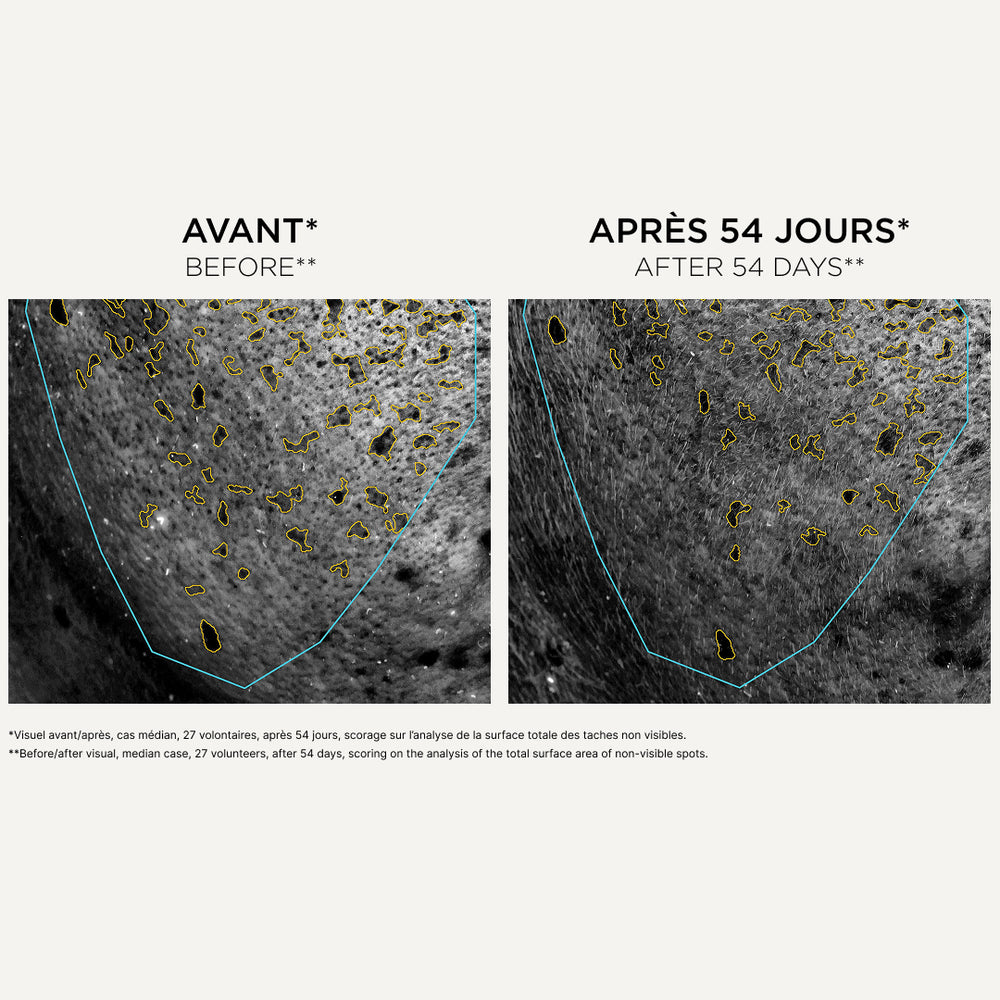 TACHES INVISIBLES identifiées par caméra UV
